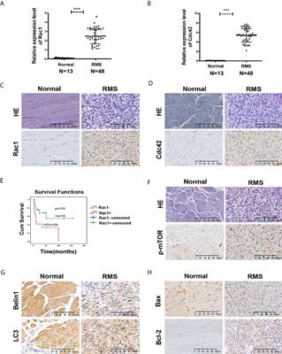 GEFT Inhibits Autophagy and Apoptosis in Rhabdomyosarcoma via Activation of the Rac1/Cdc42-mTOR Signaling Pathway